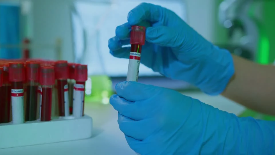 Laboratory specimens being carefully handled with protective gloves